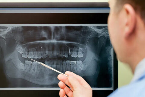 Doctor inspecting the x-ray